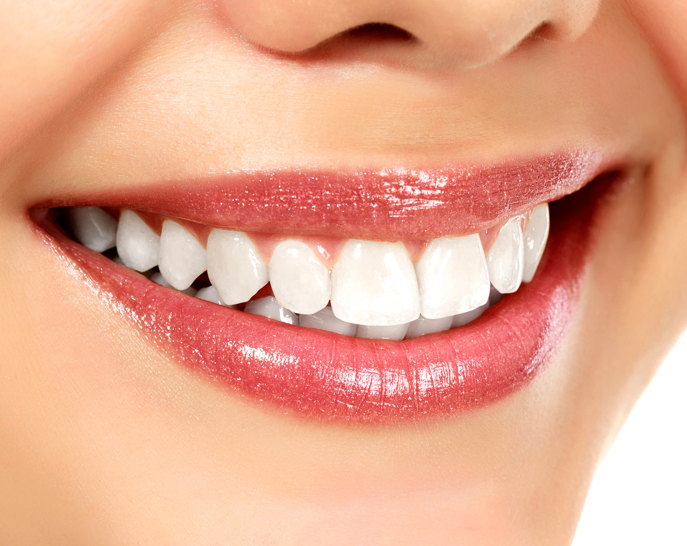 Tooth whitening at Roca Santiago Dental Clinic Fuengirola - Málaga