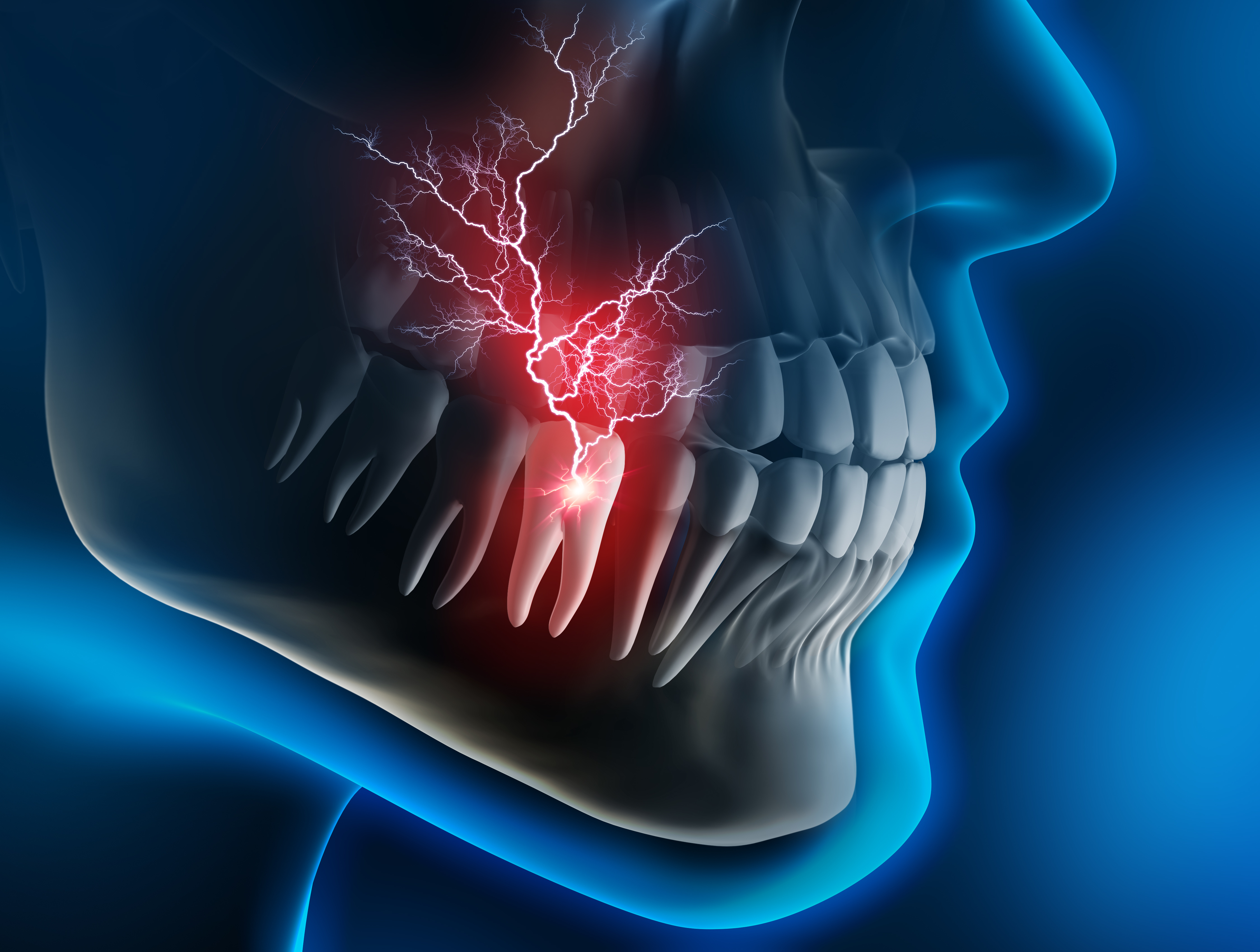 endodoncia en Clínica Dental Roca Santiago Fuengirola - Málaga