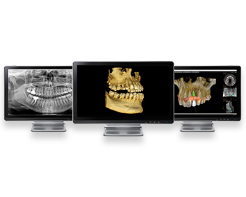 Escáner intraoral en Clínica Dental Roca Santiago en Fuengirola- Málaga Escáner intraoral en Clínica Dental Roca Santiago en Fuengirola- Málaga