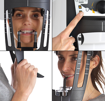 1 CBCT 3d scanner - technological advances at Clínica Dental Roca Santiago- Fuengirola - Málaga