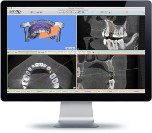 DIGITAL WORKFLOW AT CLÍNICA DENTAL ROCA SANTIAGO - FUENGIROLA- MÁLAGA