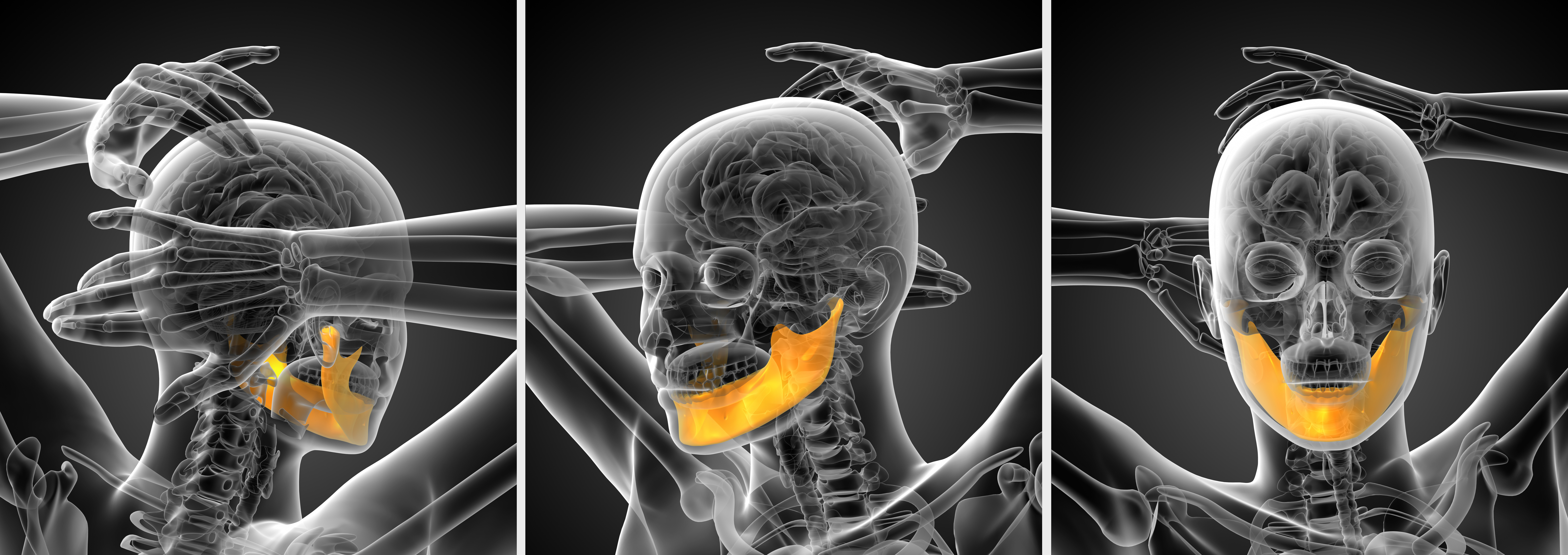 Oclusión dental - Clínica Dental Roca Santiago - Fuengirola- Málaga Oclusión dental - Clínica Dental Roca Santiago - Fuengirola- Málaga